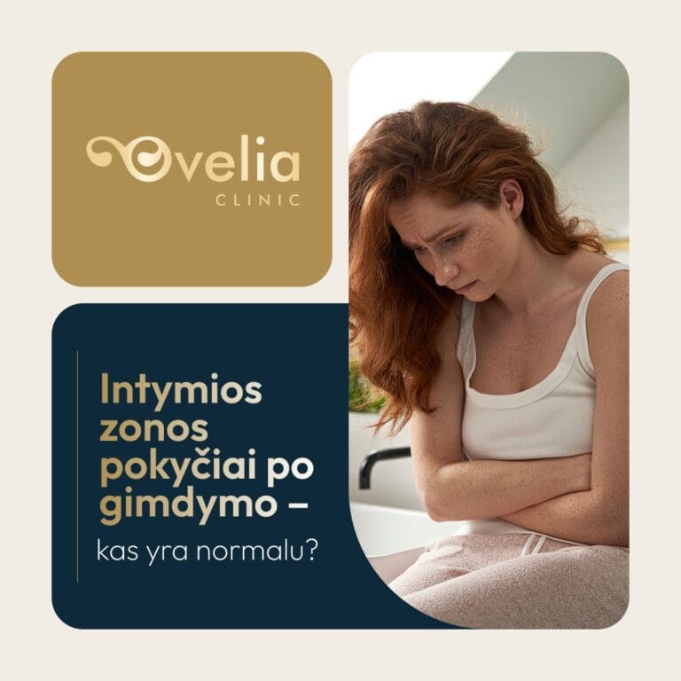 Ovelia - advertising design