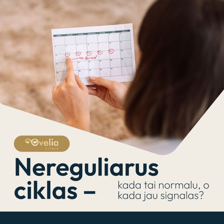 Ovelia - advertising design